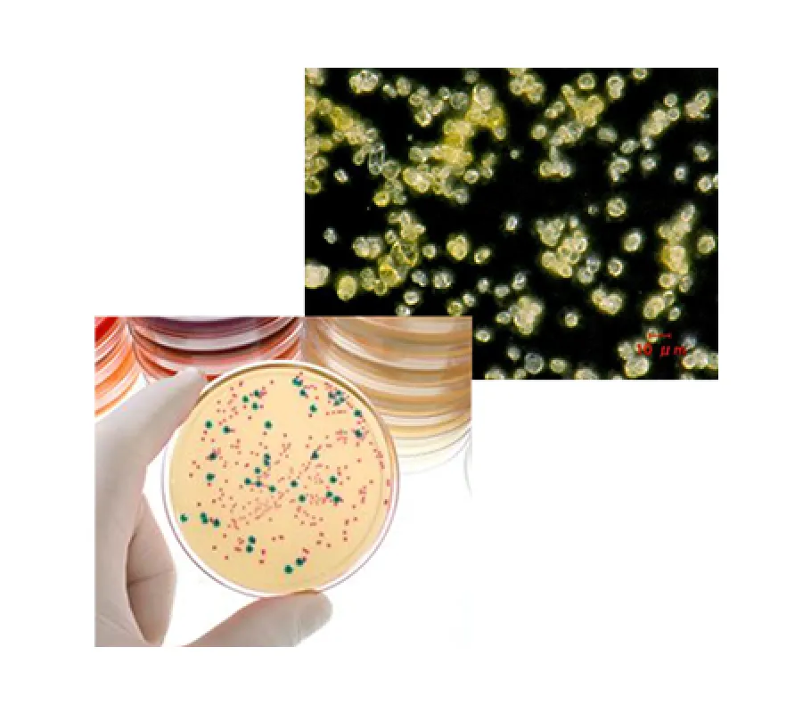 細菌培養の写真。