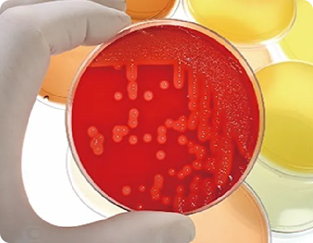手袋をはめた手が赤い寒天培地を持っている。